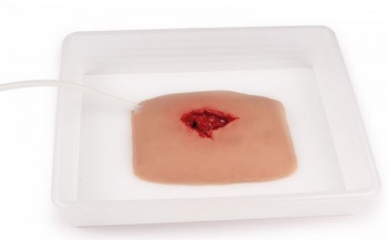 Wundmoulage wound packing